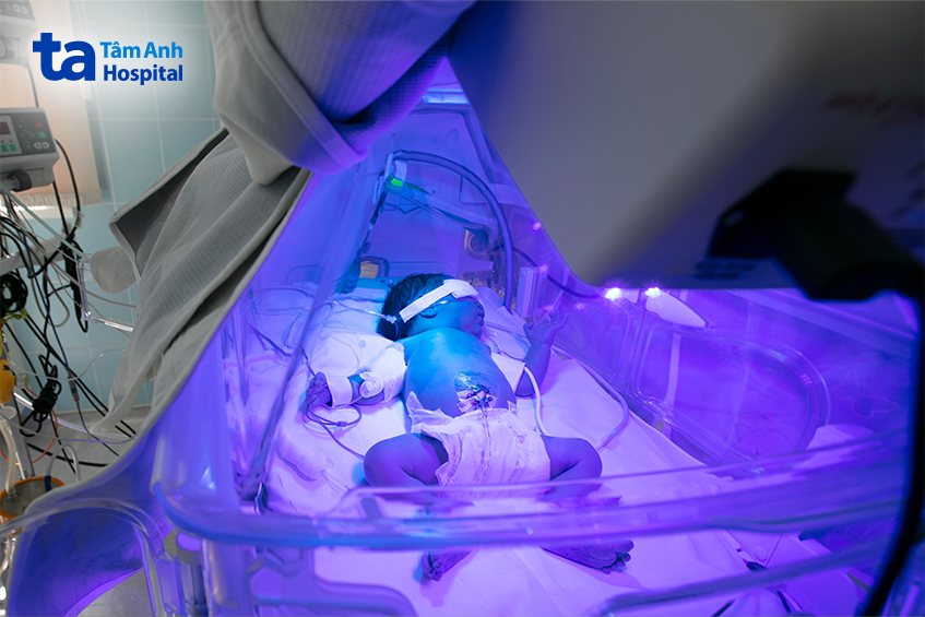 trẻ sinh non hay gặp phải tình trạng tăng bilirubin máu