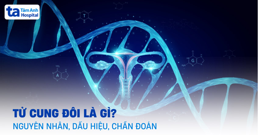 Tử cung đôi là gì? Nguyên nhân, dấu hiệu, chẩn đoán và điều trị