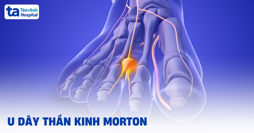 Oshxonada yashirin kamera pornosini tomosha qiling Mushuk va eshakdan oqayotgan sperma fotosurati