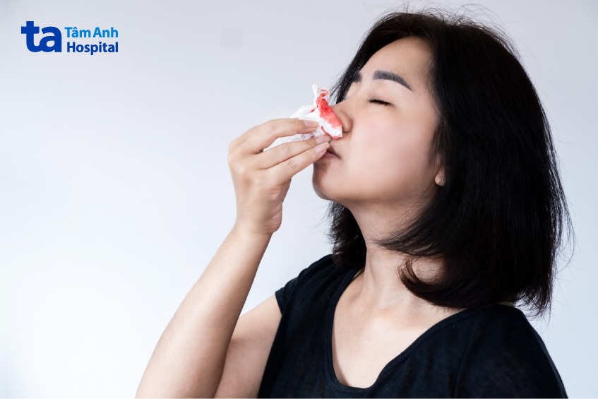 u hốc mũi có nguy hiểm không