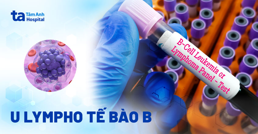 u-lympho-tế-bào-b