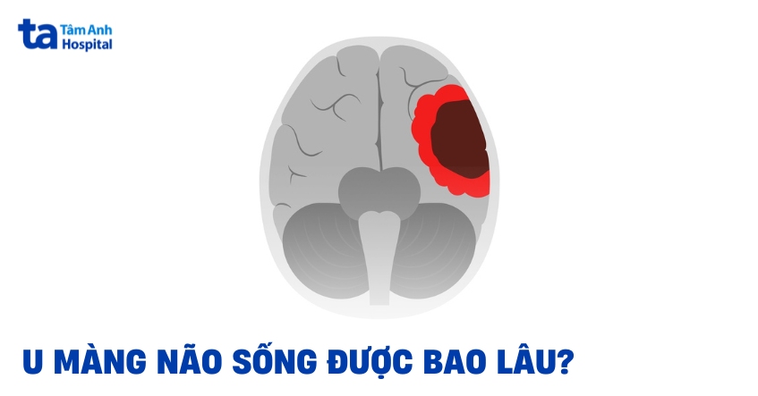 U màng não sống được bao lâu? Tiên lượng tỷ lệ sống sót