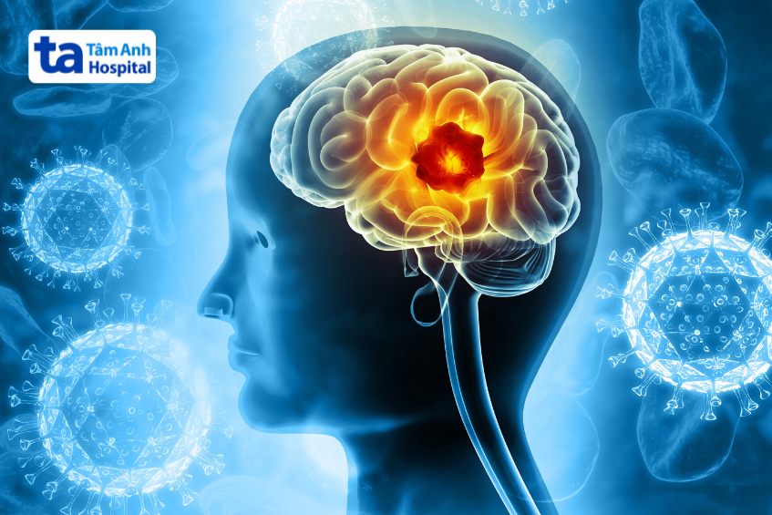 u não chữa được không phụ thuộc nhiều yếu tố