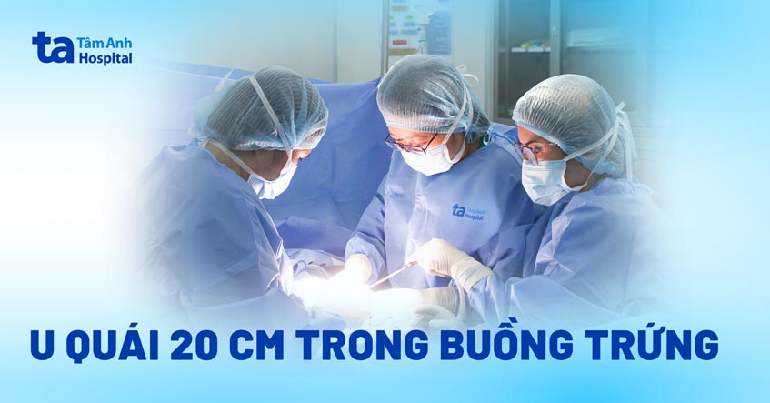 u quái 20 cm trong buồng trứng