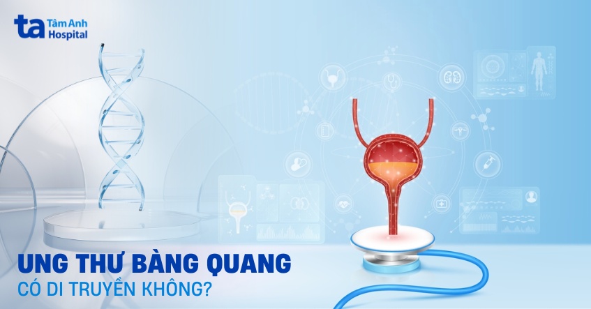 Ung thư bàng quang có di truyền không? Phát hiện bệnh nên làm gì?