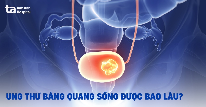 ung thư bàng quang sống được bao lâu