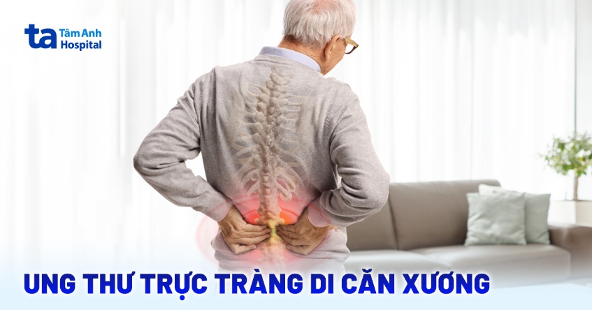 Ung thư trực tràng di căn xương: Triệu chứng, chẩn đoán, điều trị