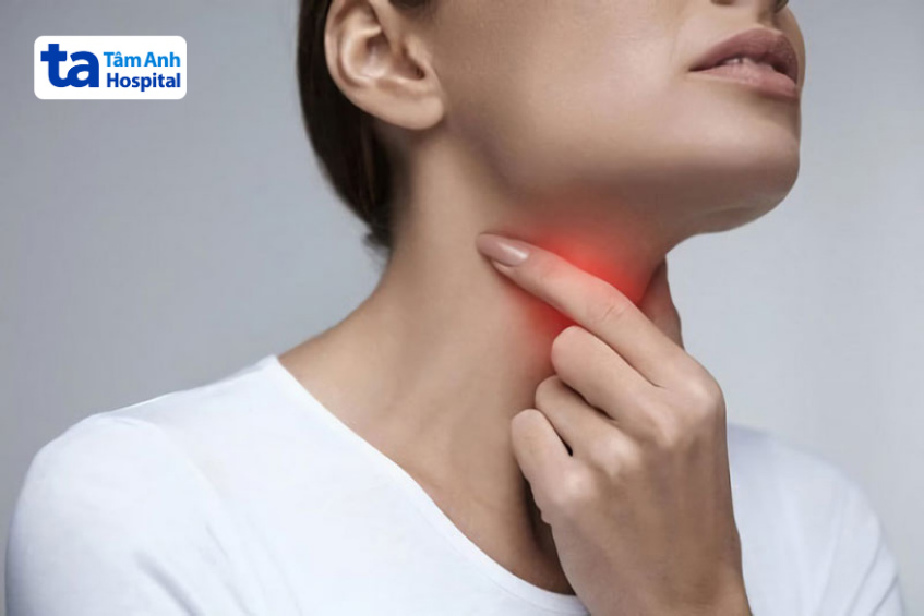 ung thư vòm họng