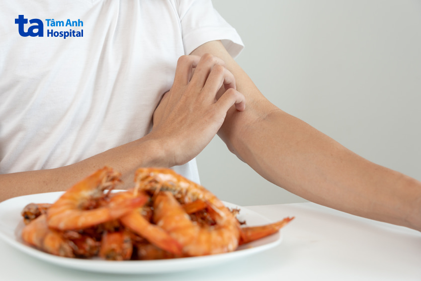 viêm da dị ứng tiếp xúc kiêng ăn gì