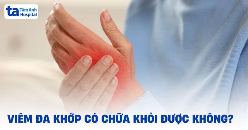 Bệnh viêm đa khớp có chữa được không? Có khỏi được hoàn toàn?