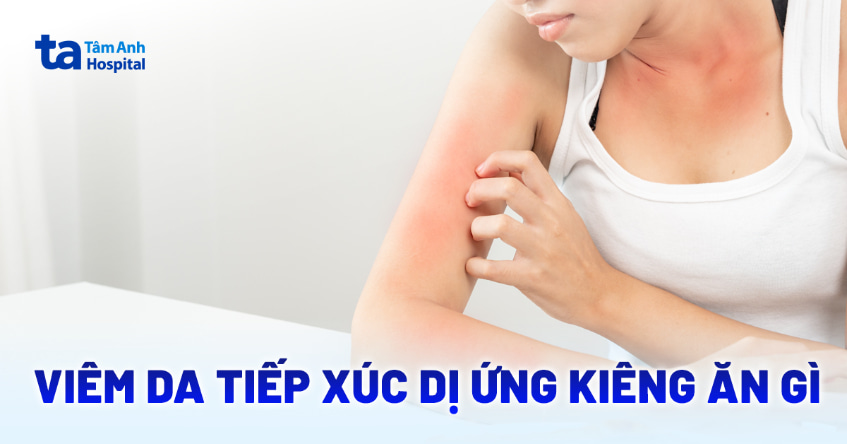 viêm da tiếp xúc dị ứng kiêng ăn gì