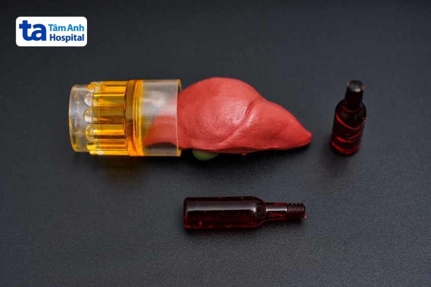 viêm gan do nhiễm độc