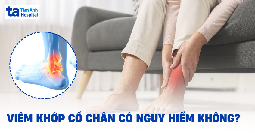 Viêm khớp cổ chân có nguy hiểm không? Biến chứng thường gặp của bệnh