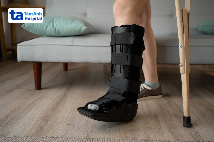 Viêm khớp cổ chân sau chấn thương khá thường gặp