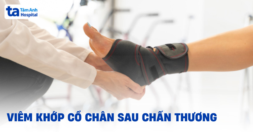 Viêm khớp cổ chân sau chấn thương: Nguyên nhân và cách điều trị
