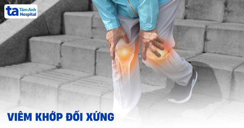 Viêm khớp đối xứng