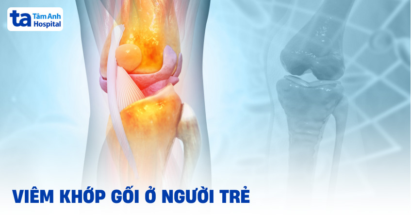 Viêm khớp gối ở người trẻ tuổi: Nguyên nhân và cách điều trị