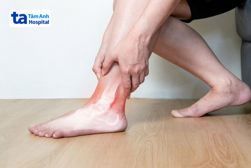 Viêm khớp kéo dài gây thoái hóa khớp cổ chân