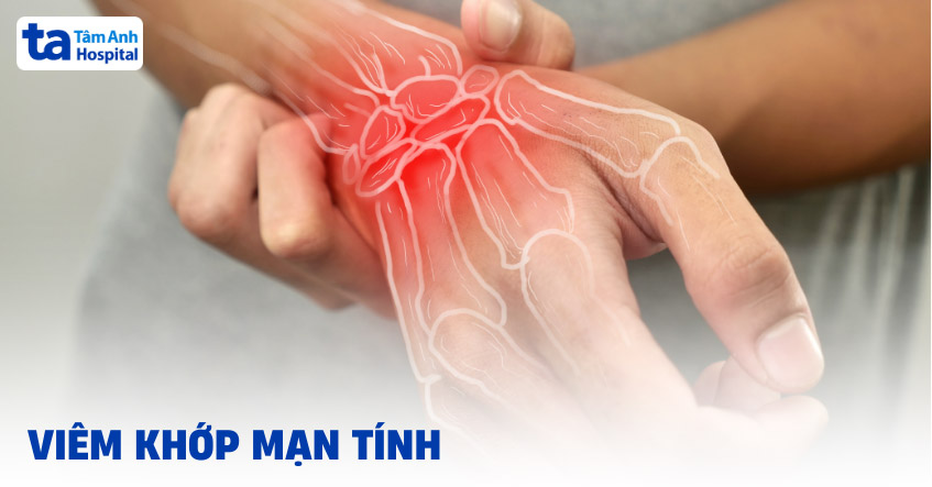 Viêm khớp mạn tính