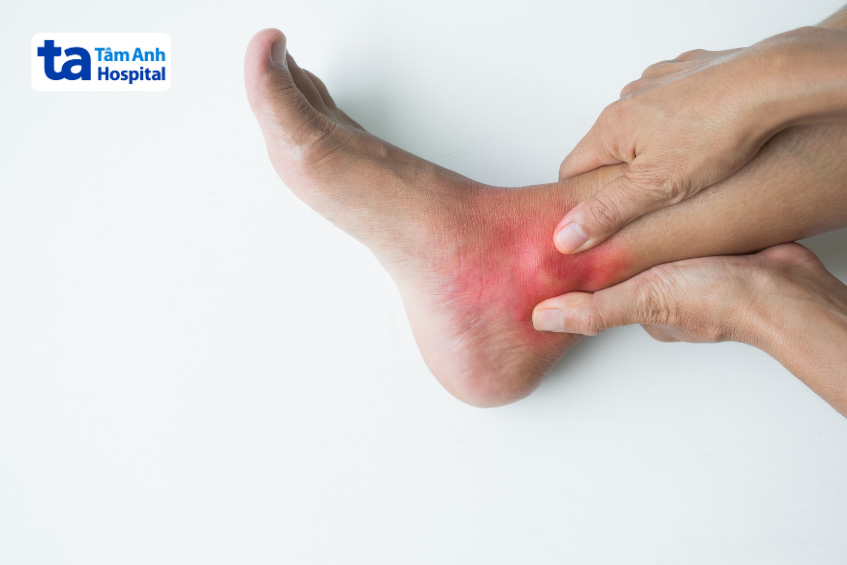 Viêm khớp mắt cá chân do bệnh tự miễn