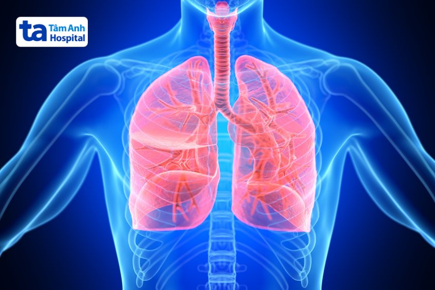viêm phế quản cấp j20 là một bệnh lý đường hô hấp thường gặp