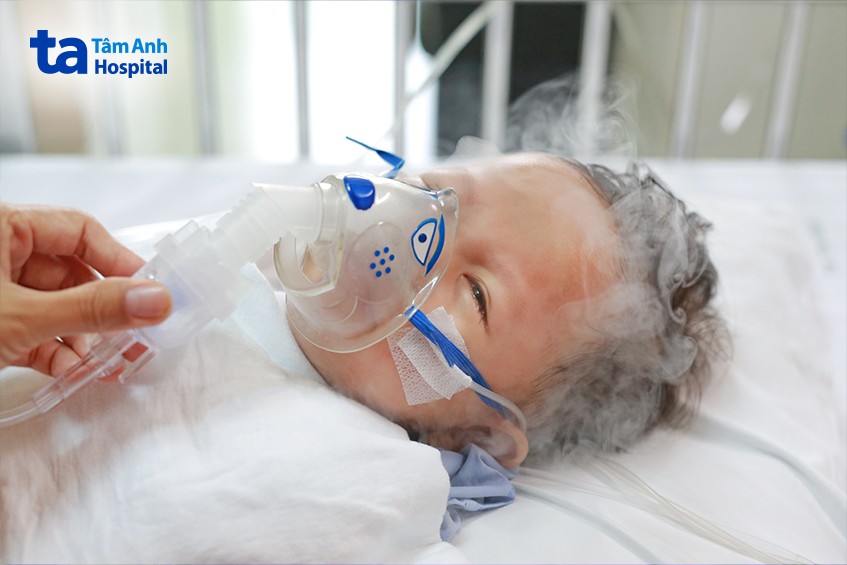 viêm tiểu phế quản là bệnh nhiễm trùng thường gặp ở trẻ sơ sinh