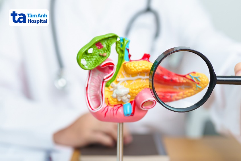 viêm túi mật biến chứng