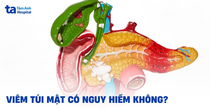Viêm túi mật có nguy hiểm không? Biến chứng có thể gặp