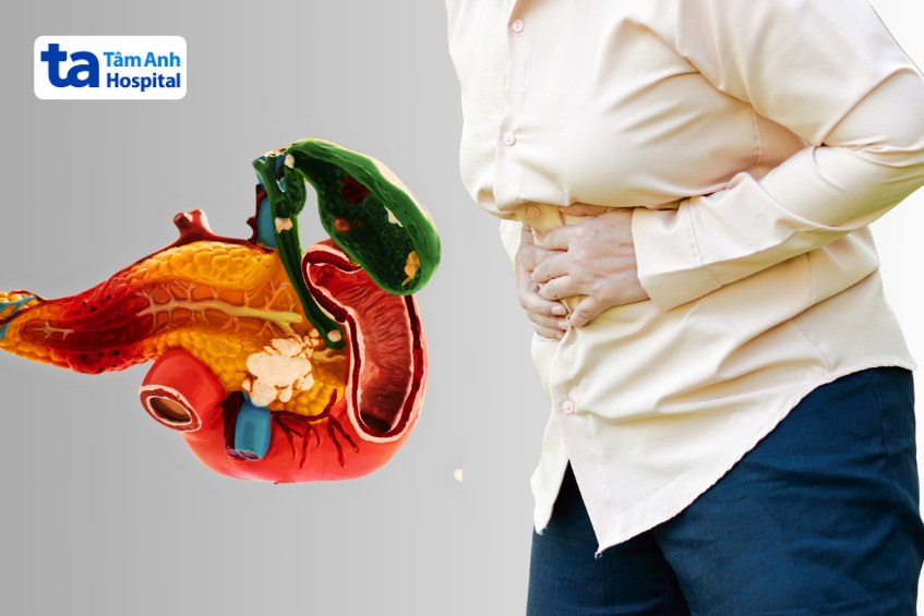 viêm túi mật nguy hiểm không