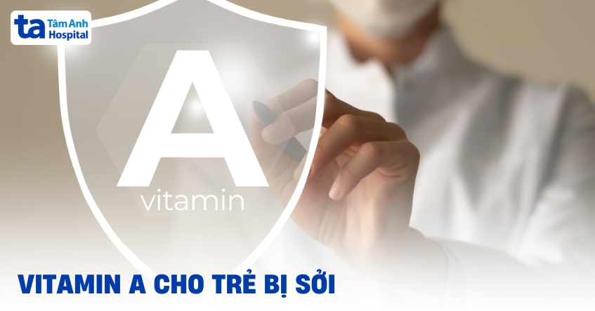 Vitamin A cho trẻ bị sởi: Vai trò, liều lượng và cách bổ sung