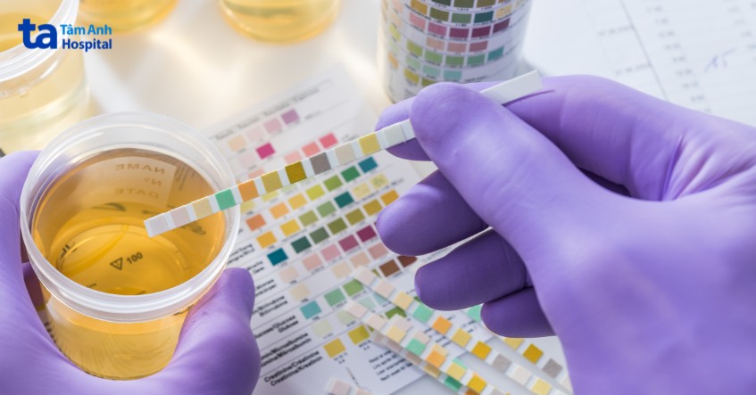 xét nghiệm chẩn đoán bệnh