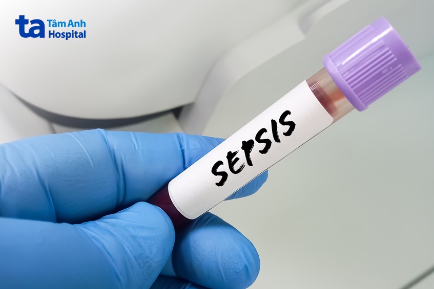 xét nghiệm tìm ra nhiễm trùng máu