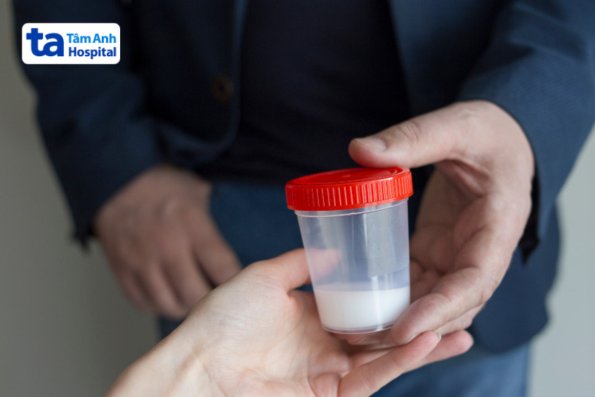 Xét nghiệm tinh dịch đồ là xét nghiệm thường quy khi khám nam khoa