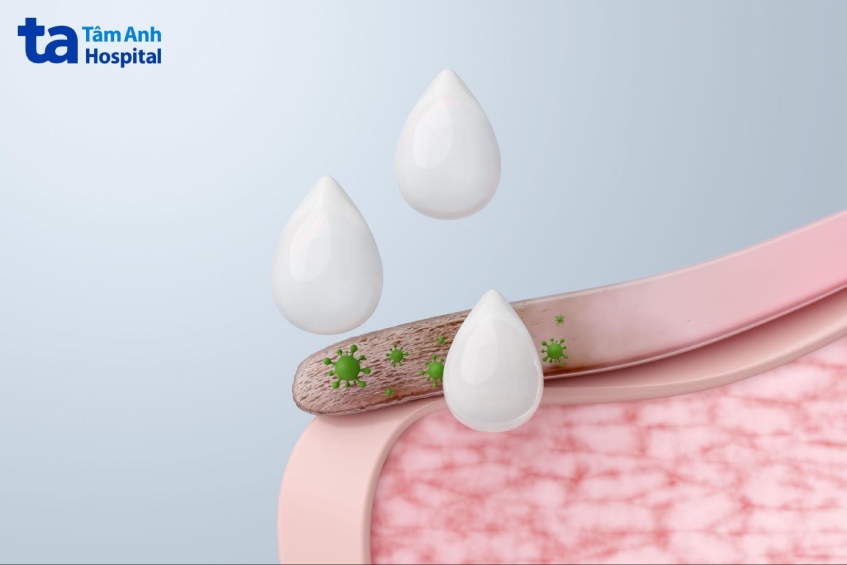 yếu tố ảnh hưởng khả năng mọc lại của móng tay