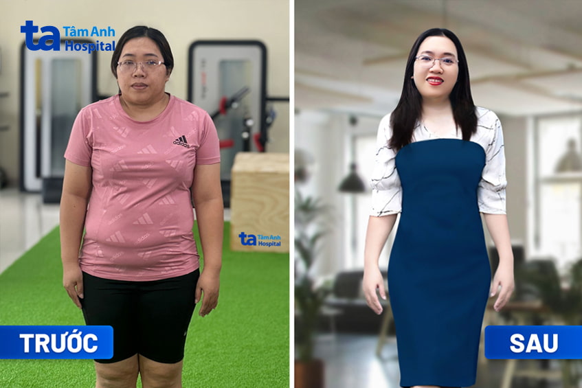 Chị Phạm Thị Ánh Dương trước và sau giảm cân