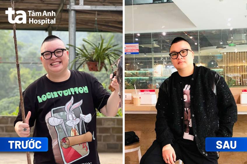 anh minh giảm cân đa mô thức tại tâm anh