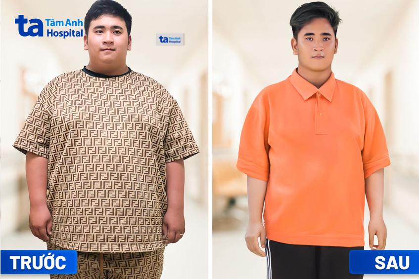 anh quang giảm 15kg sau 2 tháng tại tâm anh