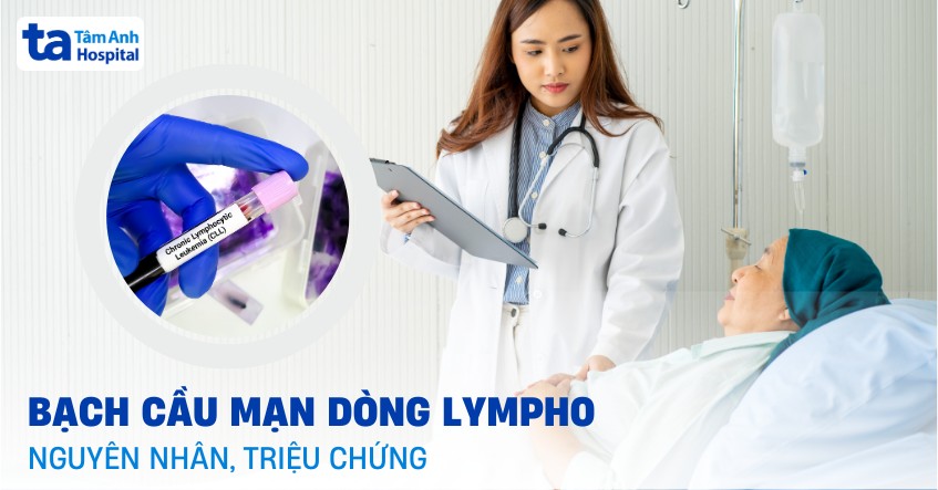 Bệnh bạch cầu mạn dòng lympho CLL: Nguyên nhân và triệu chứng