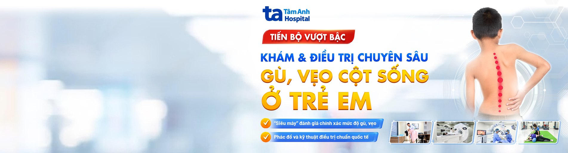 banner điều trị gù vẹo cột sống ở trẻ em chuyên khoa