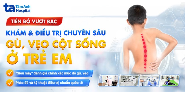 banner điều trị gù vẹo cột sống ở trẻ em mobile