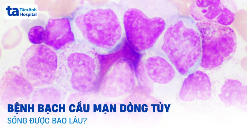 Bệnh bạch cầu mạn dòng tủy sống được bao lâu? Các yếu tố ảnh hưởng