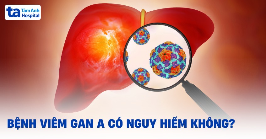 Bệnh viêm gan A có nguy hiểm không? Biến chứng ra sao?
