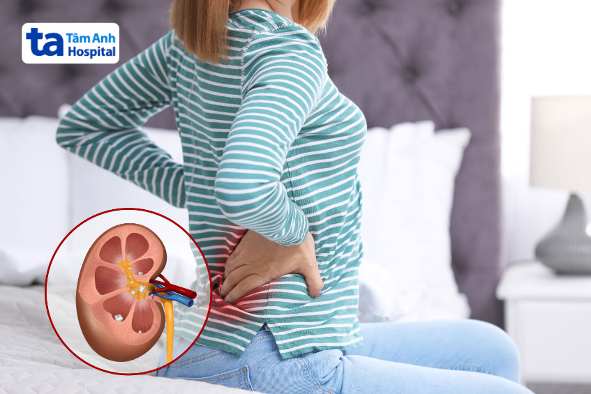  bị đau vùng thận có thể được bác sĩ 