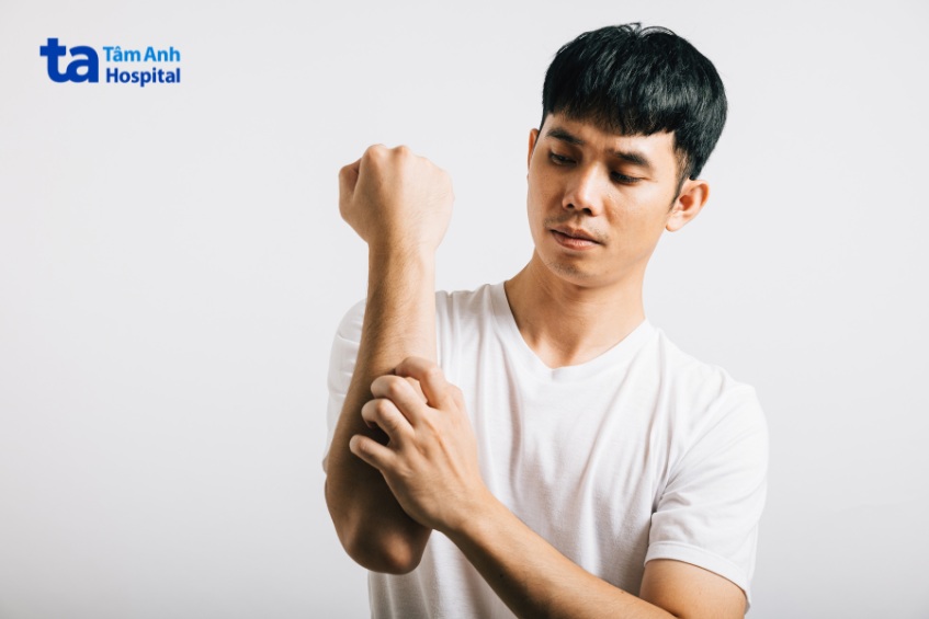 bị ghẻ nước tránh gãi mạnh