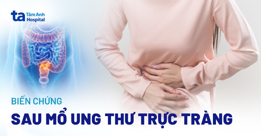 Biến chứng sau mổ ung thư trực tràng và cách để hạn chế