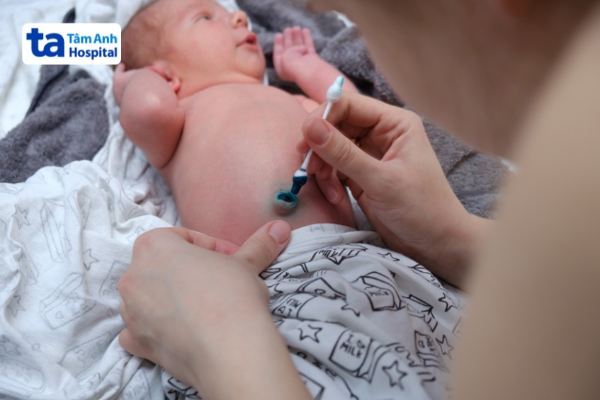 bố mẹ cần chăm sóc rốn cho trẻ sơ sinh đúng các