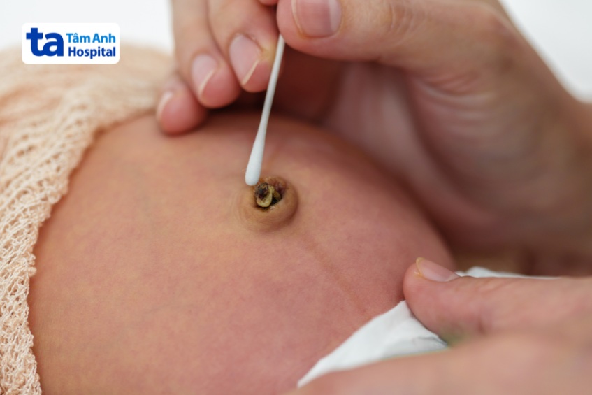 bố mẹ cần chú ý giữ vệ sinh rốn đúng cách