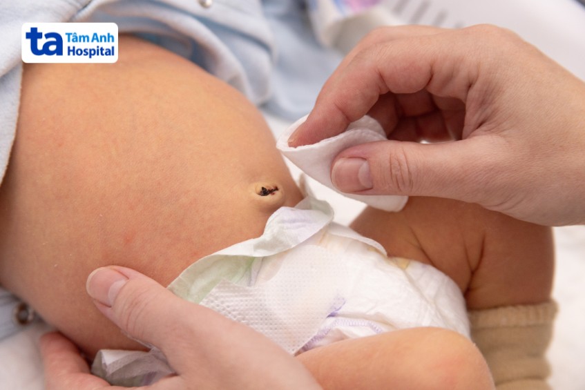 bố mẹ cần thường xuyên quan sát vùng rốn của trẻ