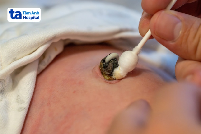 bố mẹ vệ sinh rốn cho trẻ theo đúng hướng dẫn của bác sĩ