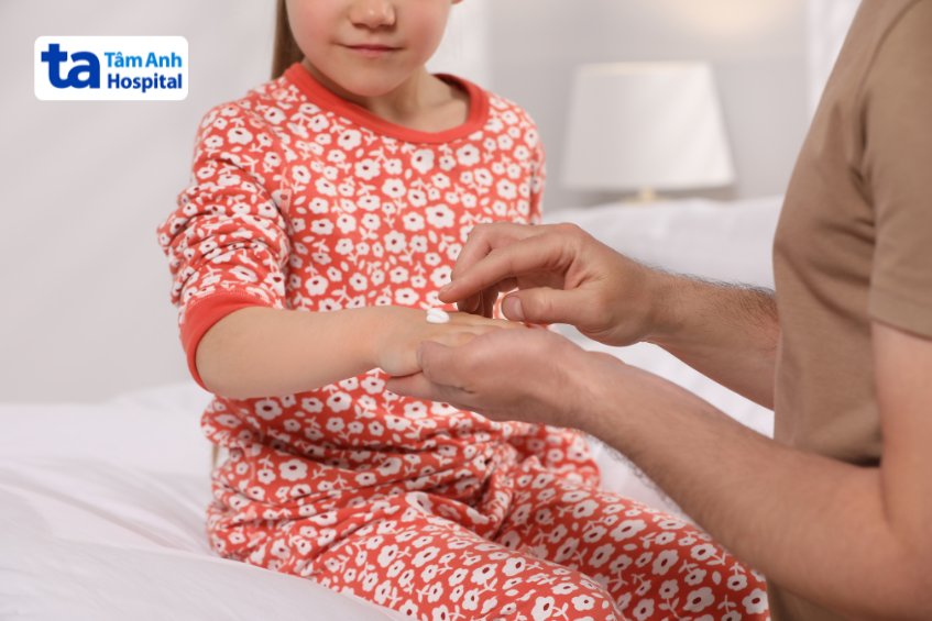 bôi thuốc điều trị tay chân miệng bội nhiễm cho trẻ